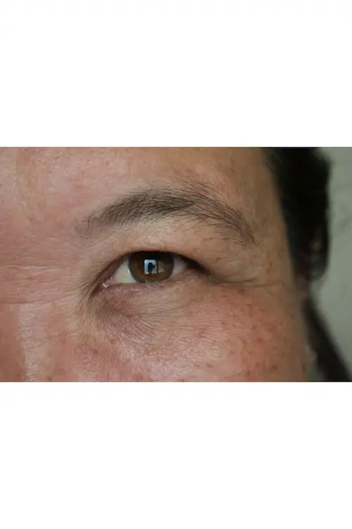 Mujer con lineas de expresion marcadas